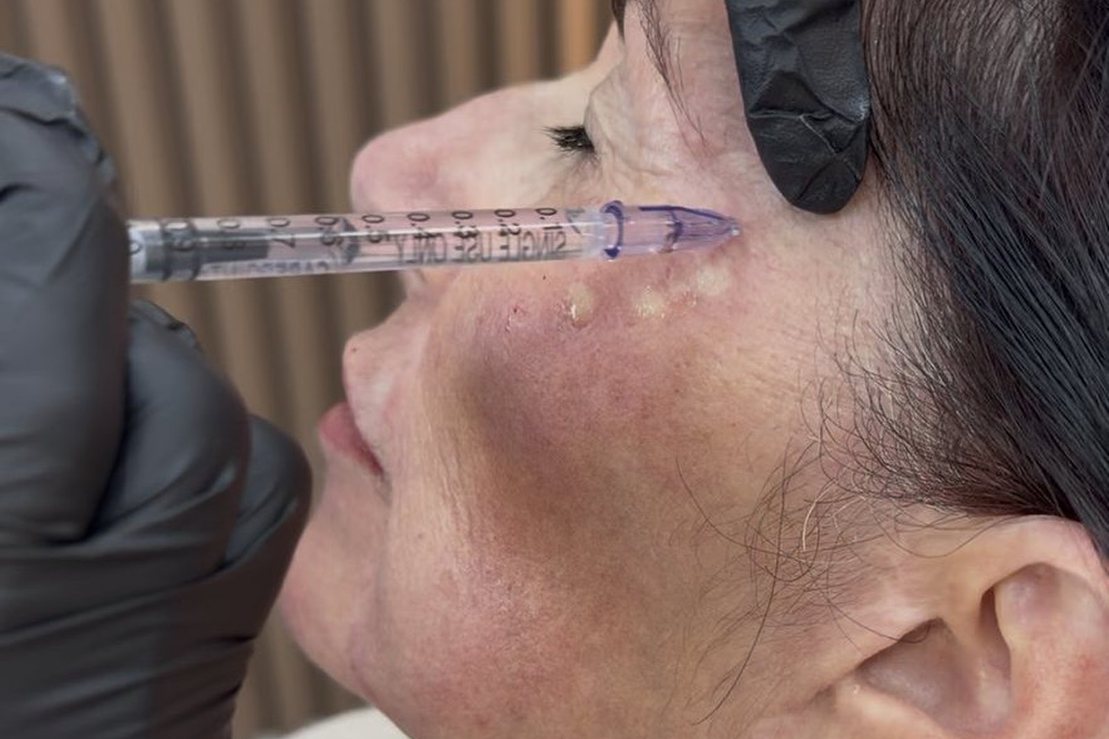 Tratamento de emagrecimento médico em Orlando na EZ Aesthetics & Wellness
