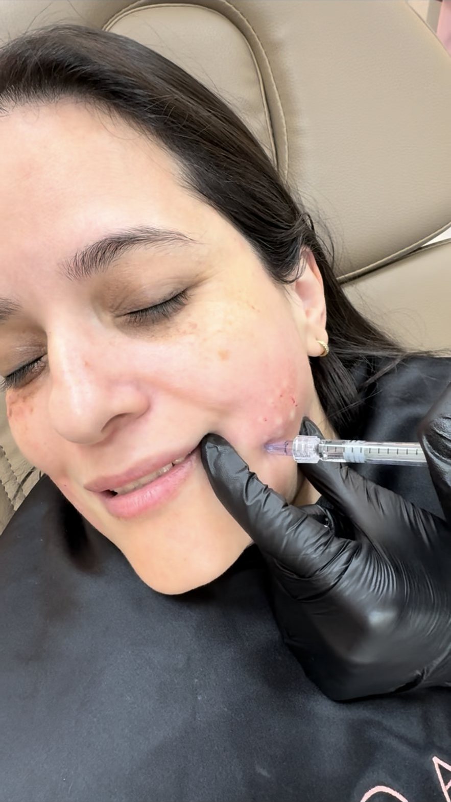 Aplicação de mesoterapia facial em Orlando na clínica EZ Aesthetics & Wellness