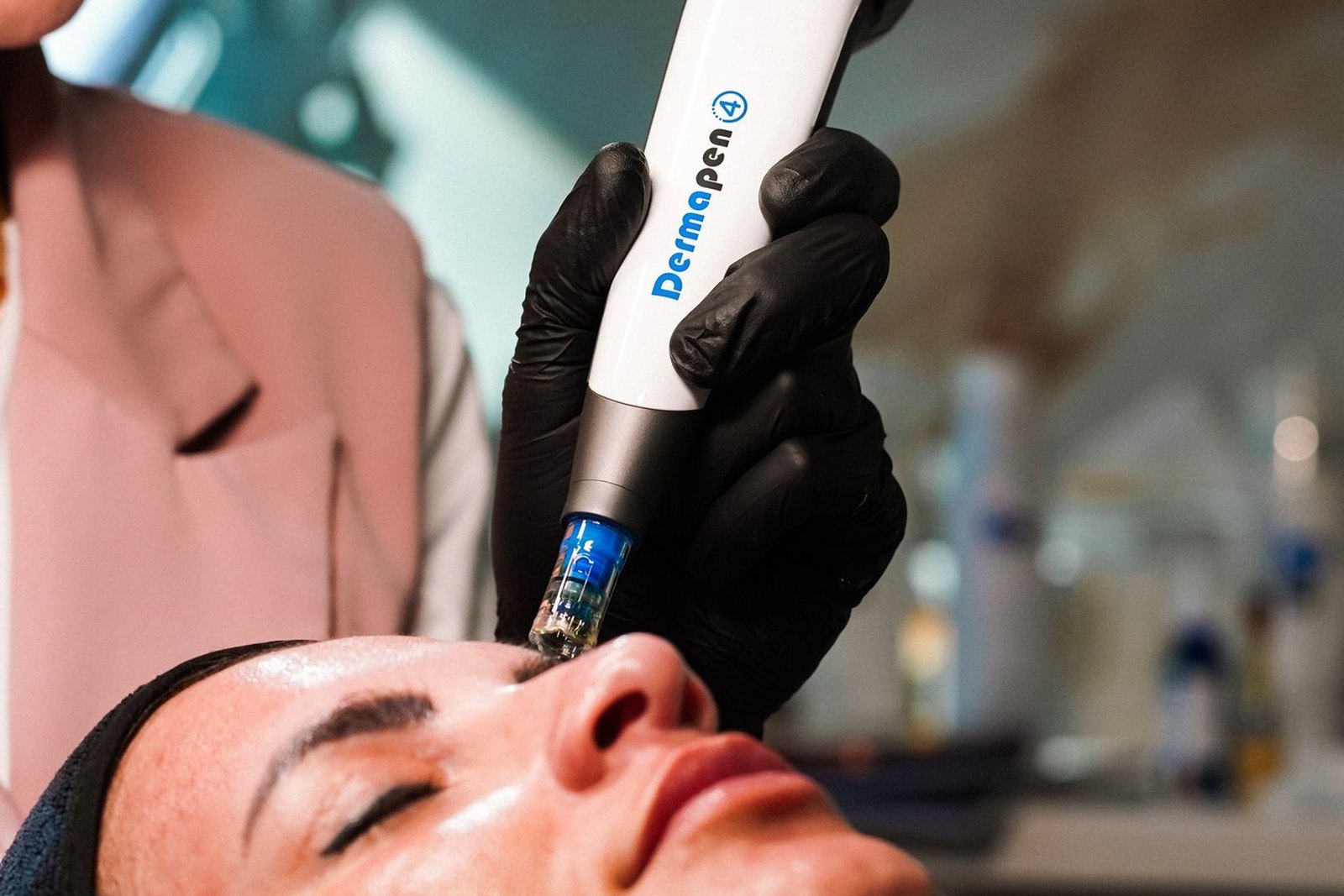 Procedimiento de microagujas en Orlando con drug delivery en la clínica EZ Aesthetics & Wellness