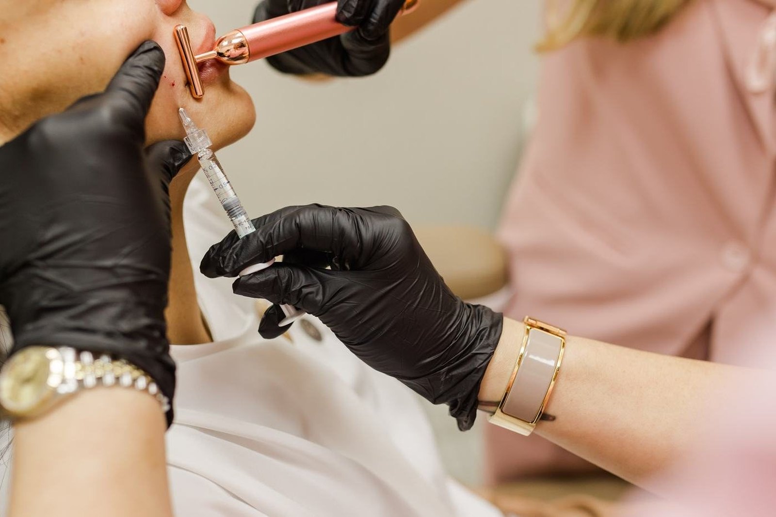 Procedimento de preenchimento labial em Orlando realizado na EZ Aesthetics