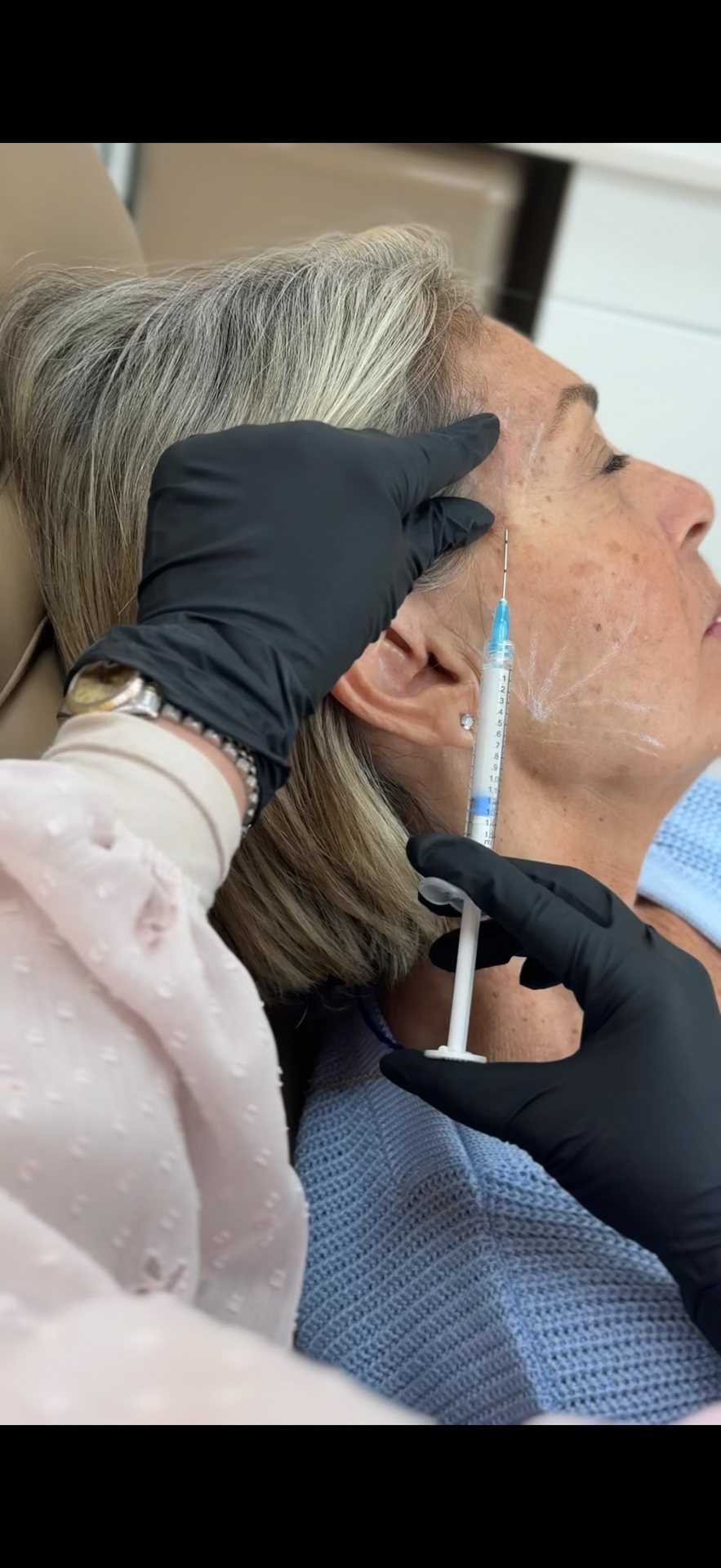 Armonización facial con rellenos en EZ Aesthetics & Wellness, Orlando