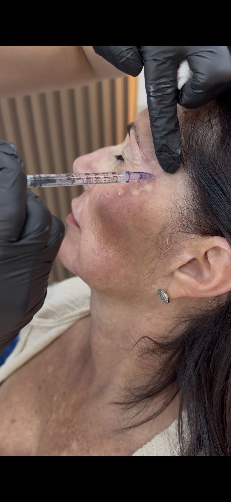 Skin cleansing and LED therapy